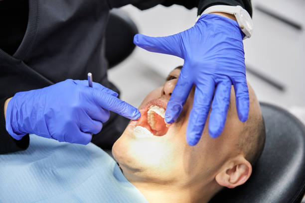 Best Broken or Chipped Tooth Repair in Navy Yard City, WA